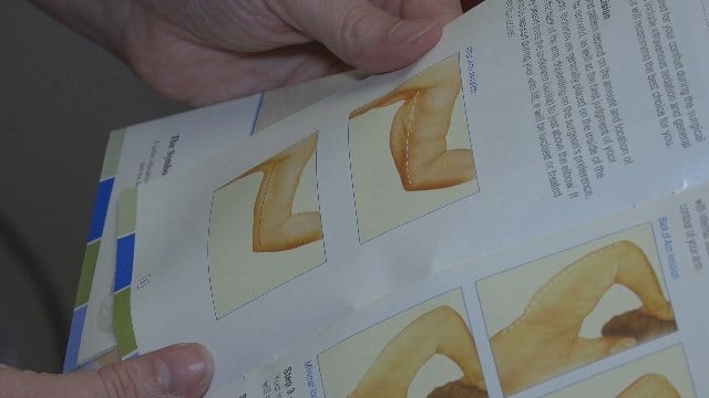 Sentara Martha Jefferson Monday: What is Body Contouring?