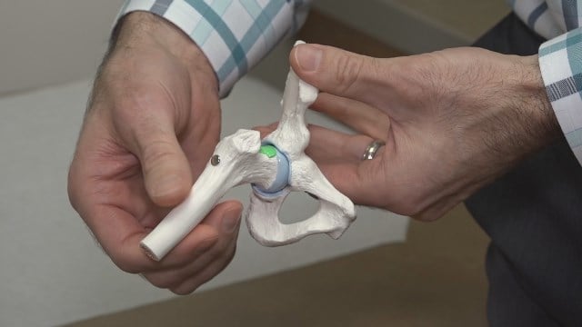 Sentara Martha Jefferson Monday: Hip Arthroscopy